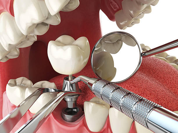Best Emergency Treatment for Oral Infections in Avoca, PA